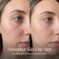 Before-and-after split screen comparison of a woman's face showing smoother skin on the right side, with text at the bottom reading 'Smoother Skin. One Step.