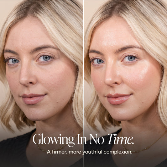 A split-screen before-and-after beauty comparison of a blonde woman's face, showing a smoother, more radiant complexion on the right. Text at the bottom reads, 'Glowing In No Time.