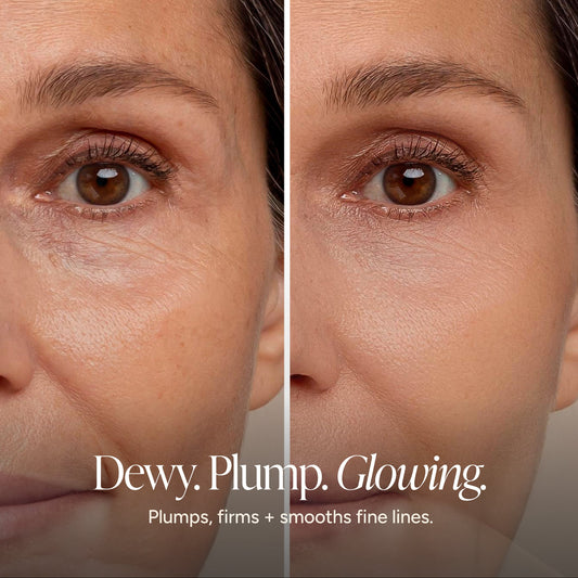 Before-and-after split screen comparison of a woman's eye area, showing wrinkle reduction and smoother skin. Text at the bottom reads 'Dewy.