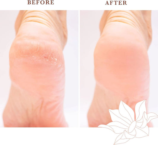 Beauty By Earth - Pumice Stone - Before and After