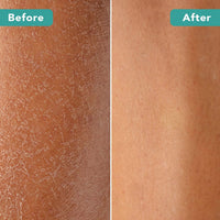Dry Brush With Cellulite Massager - Before and After