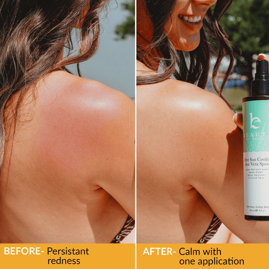 After Sun Cooling Spray
