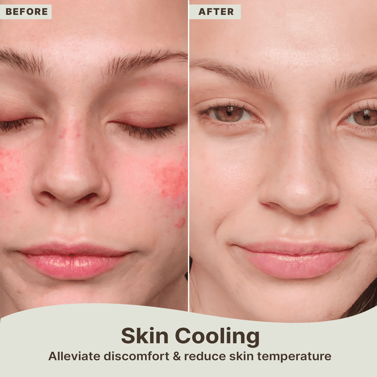 Before and after comparison of a person's face with redness, showing the effect of skin cooling.