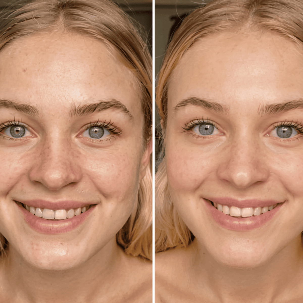 Before and after comparison of a woman's face with visible skin improvement.