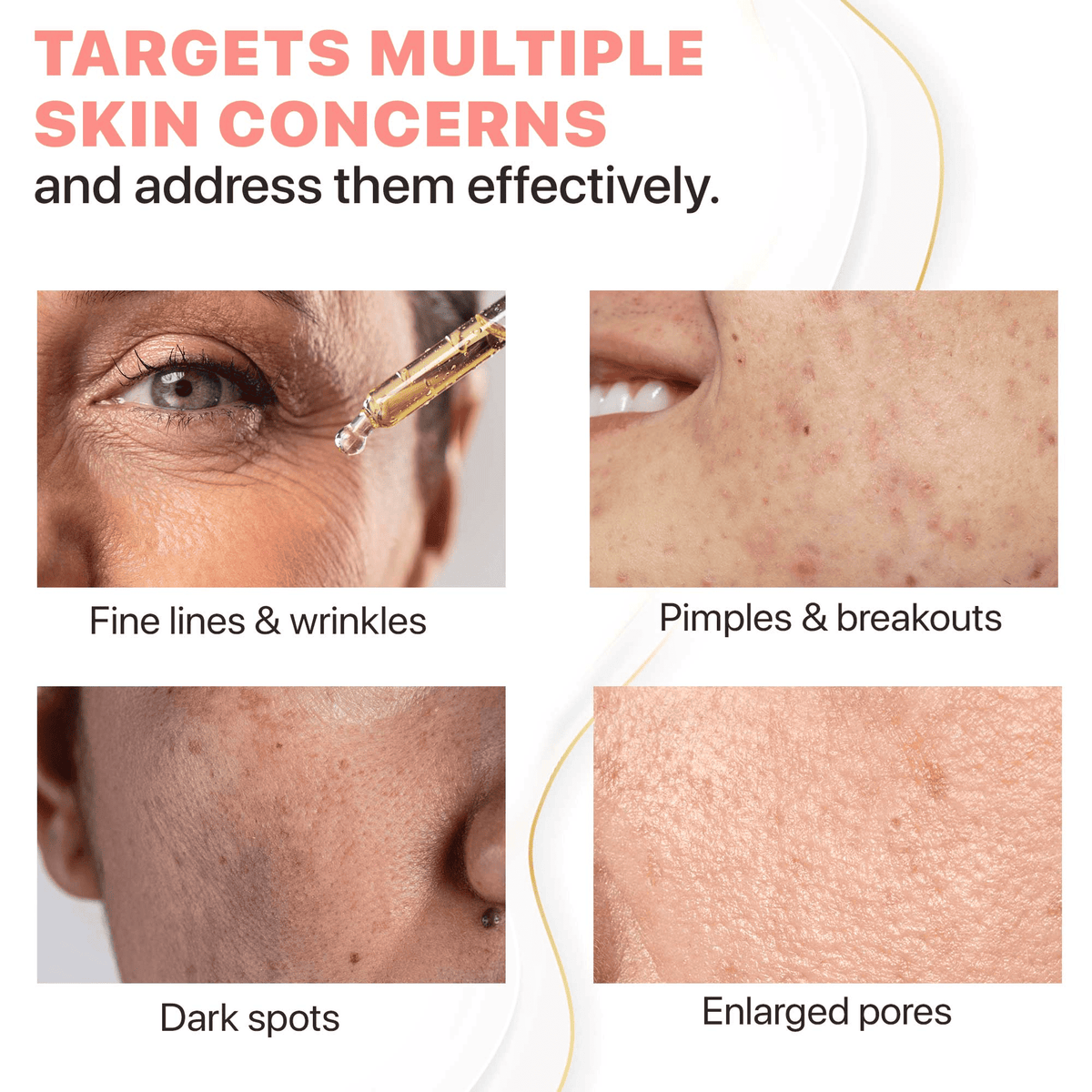 Product targeting multiple skin concerns with close-up images of skin issues.