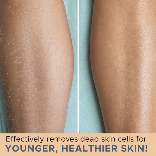Comparison of skin before and after treatment with exfoliating gloves and with text 'Effectively removes dead skin cells for younger, healthier skin'.