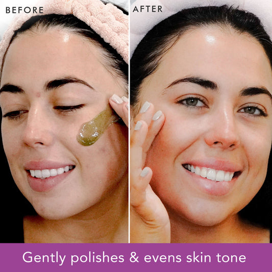 Before and after comparison of a woman applying a skincare product to her face.
