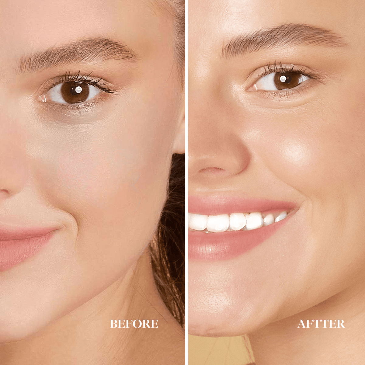 before after 