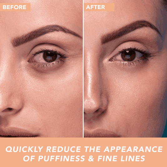 Before and after comparison of a woman's eye area with text indicating reduction of puffiness and fine lines.