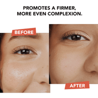Before and after comparison of a woman's eye area with text promoting skin firmness.