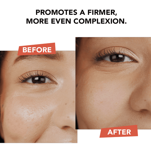 Duo de vitamine C anti-âge hyperactif®