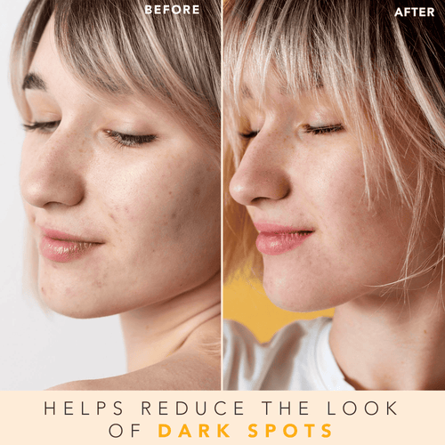 Lotion tonique anti-âge hyperactive à la vitamine C