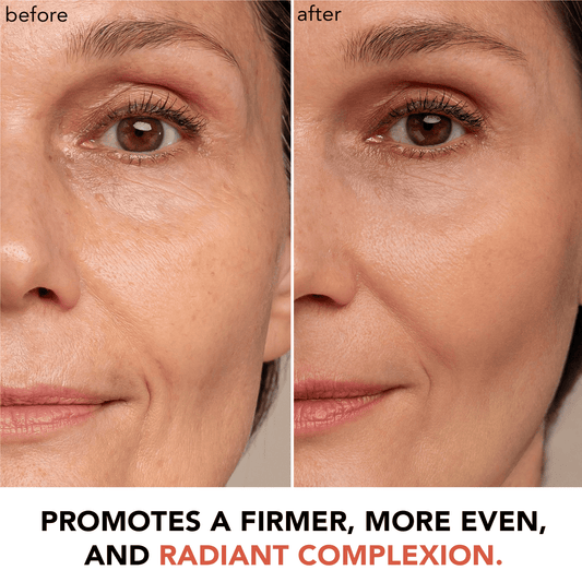 Hyperactive Anti-Aging Vitamin C Trio