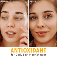 Hyperactive Anti-Aging Vitamin C Trio
