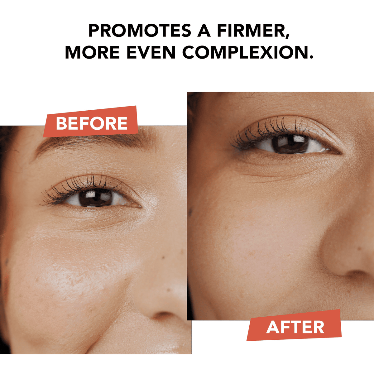Hyperactive Anti-Aging Vitamin C Trio